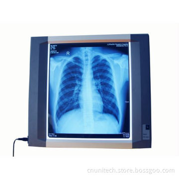 Single-Section X Ray Film Viewer